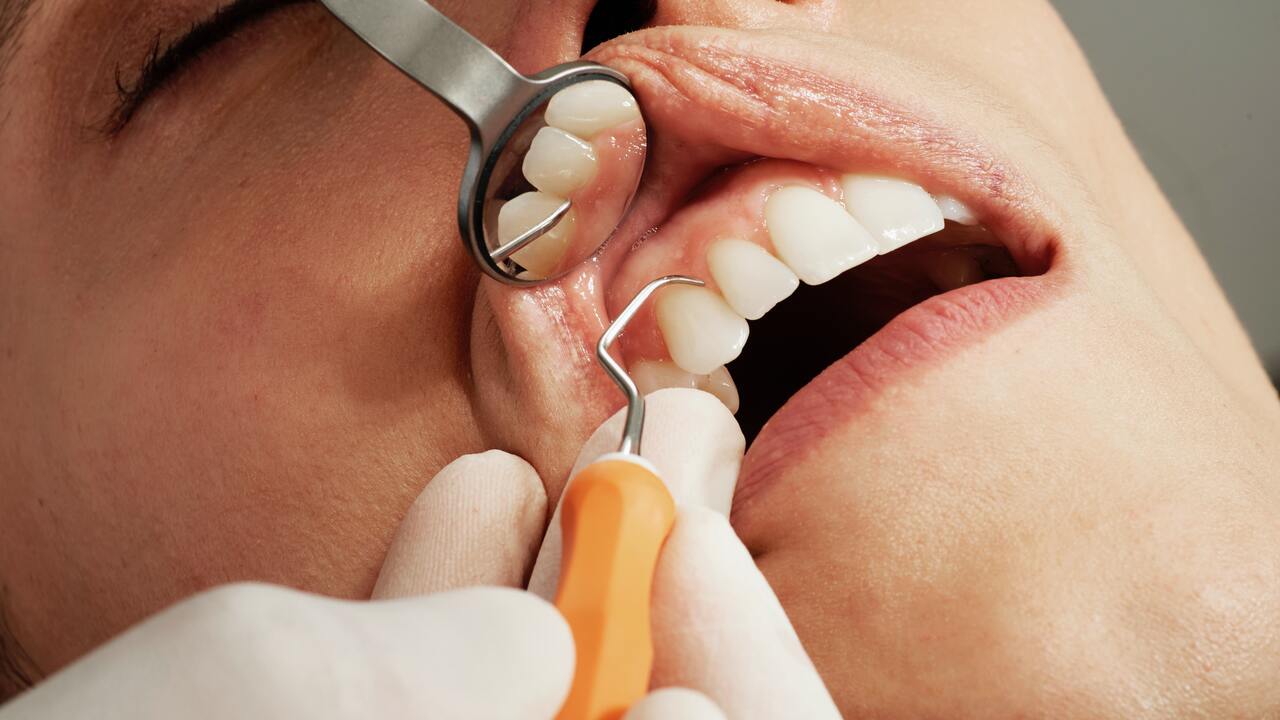 Заболевания зубов и десен