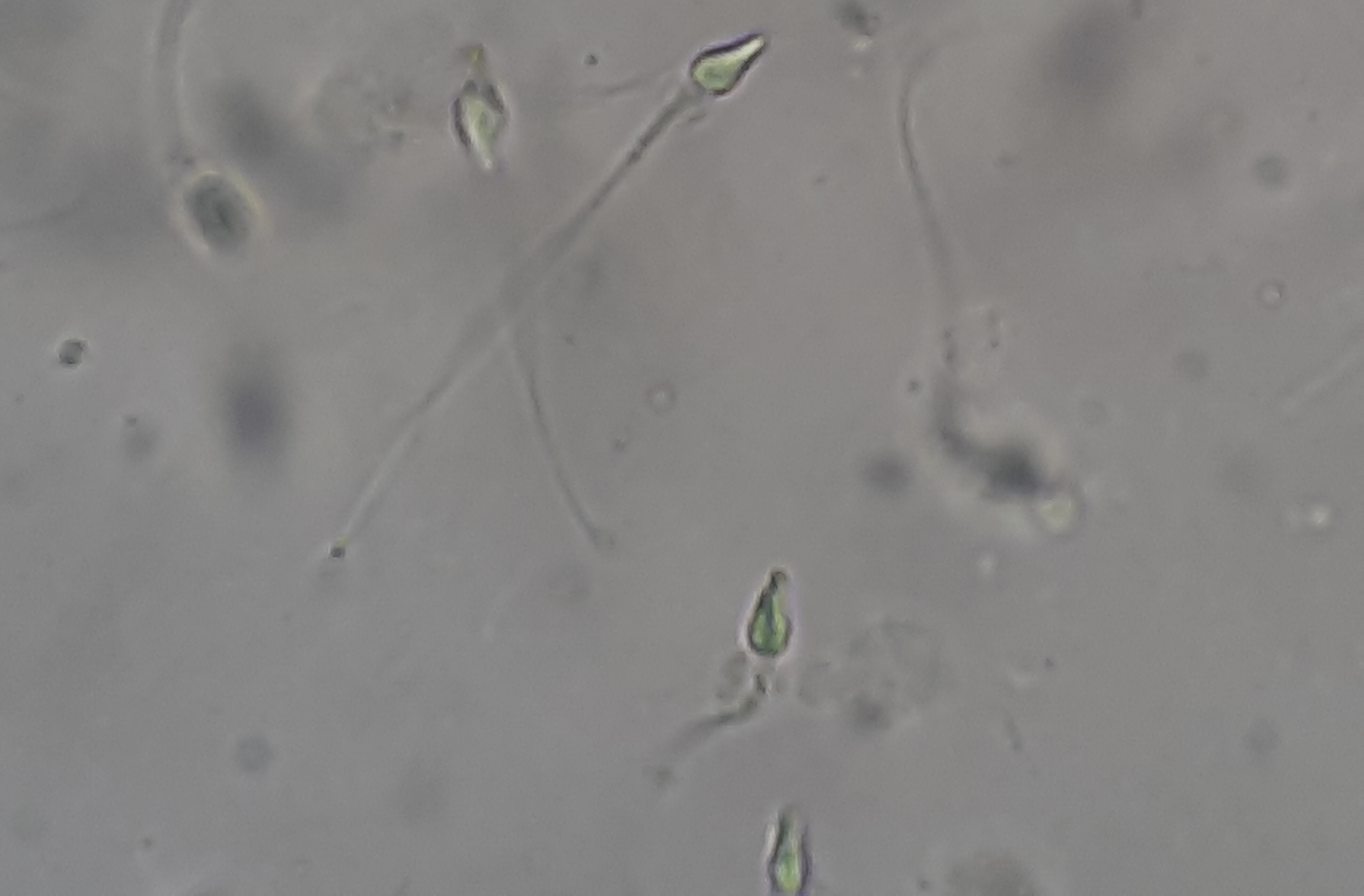 Laboratory assessment of sperm apoptosis ability in men with different fertility