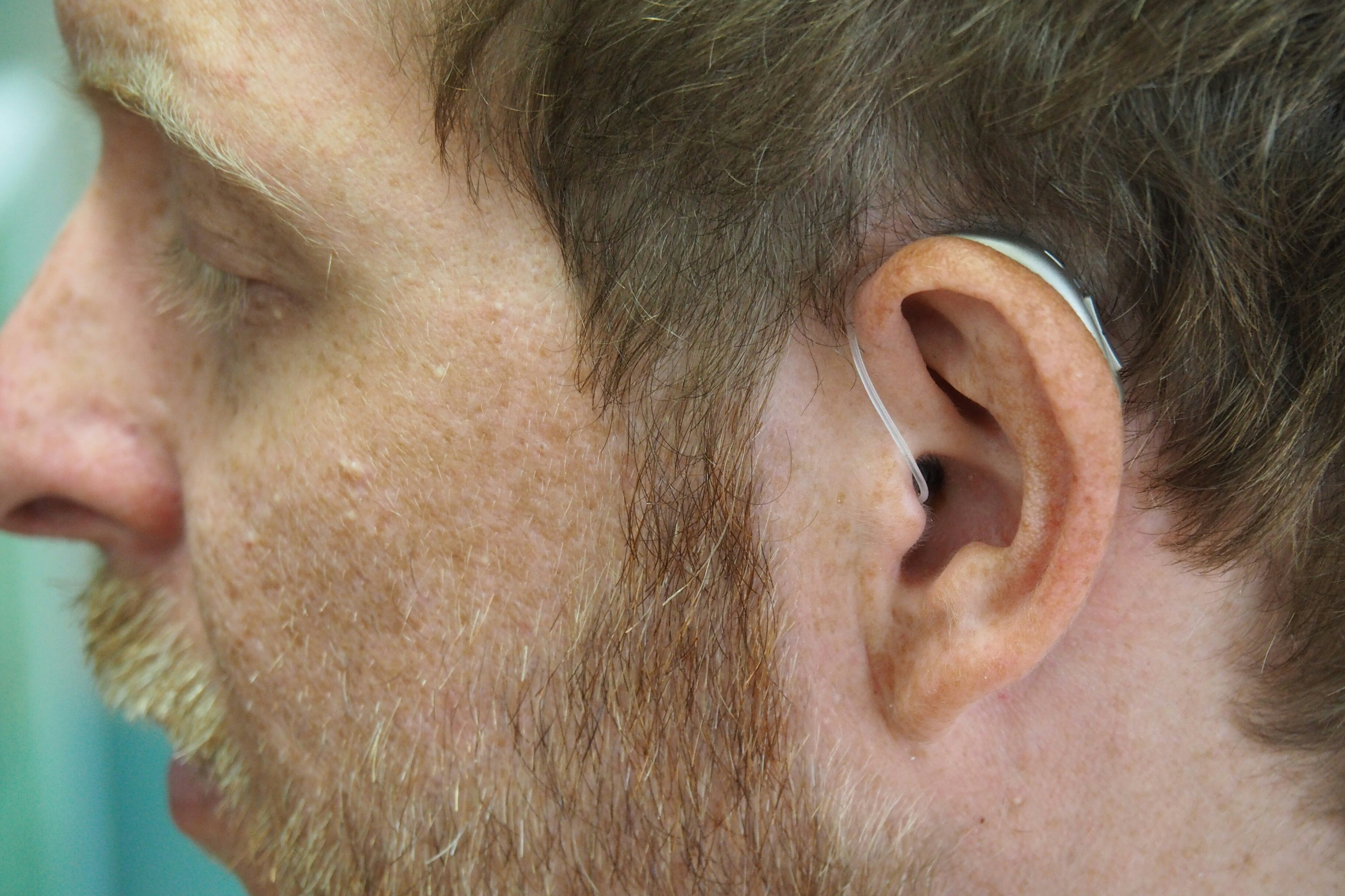 Ученые MIT создали имплантируемый аналог для слуховых аппаратов