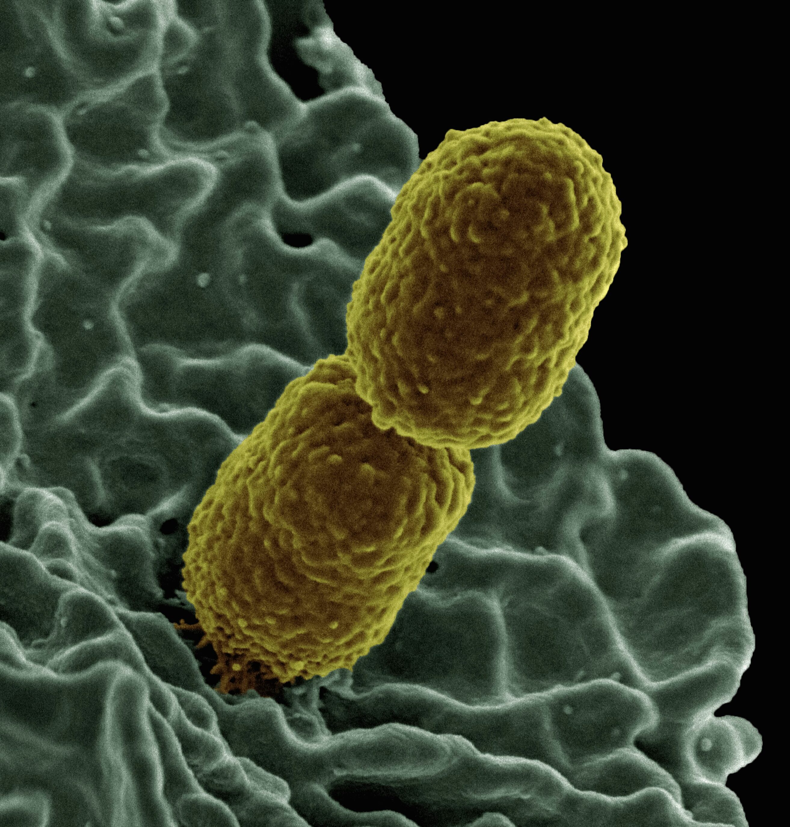 ВОЗ сообщила о быстром распространении в мире устойчивой к антибиотикам бактерии
