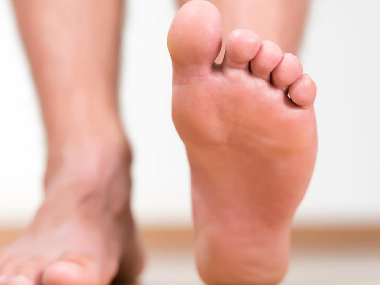 Как устранить потливость и неприятный запах ног